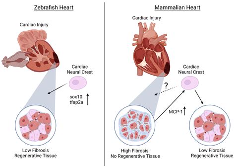 Cardiac Neural Crest and Cardiac Regeneration