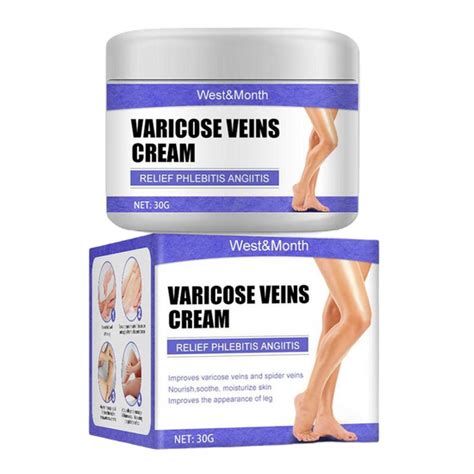 Varicose Veins Treatment Cream – bryant1202