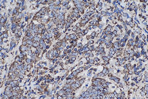 IHCeasy IDH2 Ready-To-Use IHC Kit KHC0580 | Proteintech