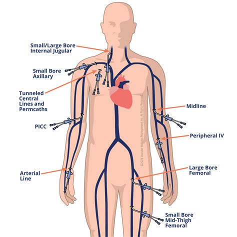 Vascular Access Patient Education | Vascular Wellness