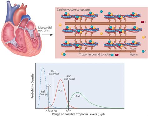 Troponin test, normal troponin levels, causes of elevated troponin levels