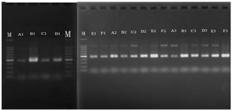 Seasonal Diversity of Endophytic Bacteria Associated with Cinnamomum ...