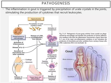 Pathophysiology of Gout | PPTX