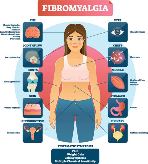 fibromyalgia tender points – Adam Sewell MD Blog
