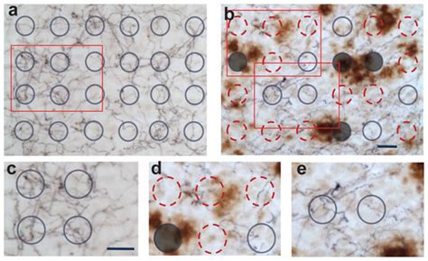 Loss of Cholinergic and Monoaminergic Afferents in APPswe/PS1ΔE9 ...