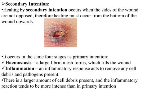 Secondary Intention Wound Healing