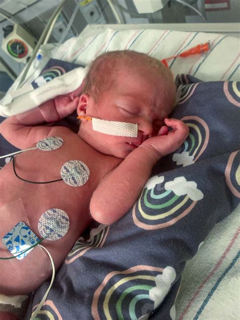 Mum with rare heart-shaped uterus defies odds to give…