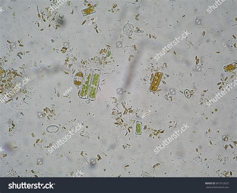 Microorganisms In Pond Water Under Microscope