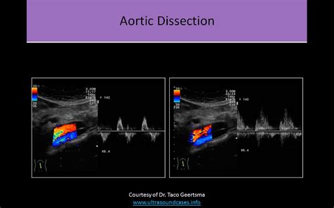 Ultrasound Registry Review - Great Vessel Anatomy