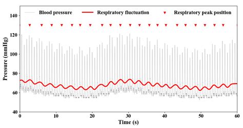 Impact of Respiratory Fluctuation on Hemodynamics in Human ...