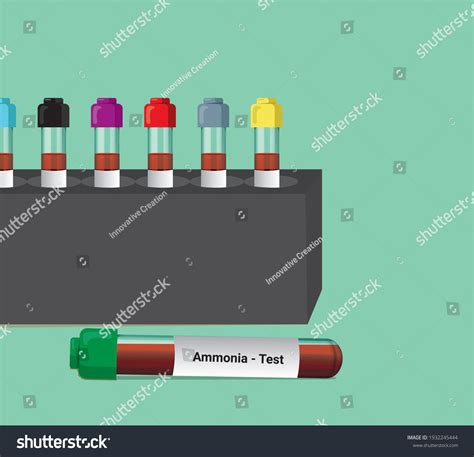 Blood Sample Ammonia Test Medical Testing Stock Vector (Royalty Free) 1932245444 | Shutterstock