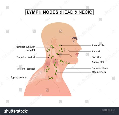 Ear Infection Lymph Nodes Swell at Dennis Aguayo blog