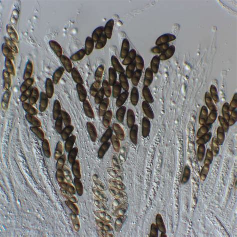 Xylaria Under Microscope