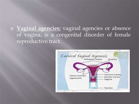 Image result for Female Reproductive System Disorders