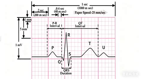 How to Read an EKG Quickly & How Do You Count Heart Rate on ECG