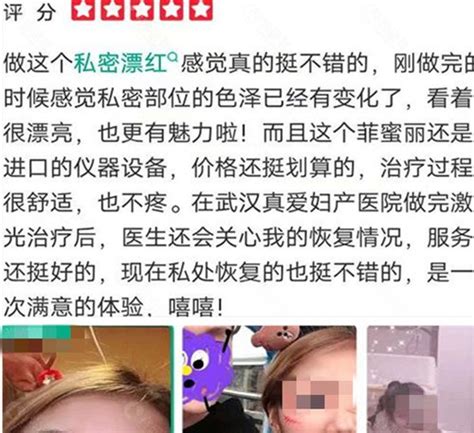 武汉真爱妇科医院私密整形怎么样?是正规医院吗？附价格表 - 爱美容研社