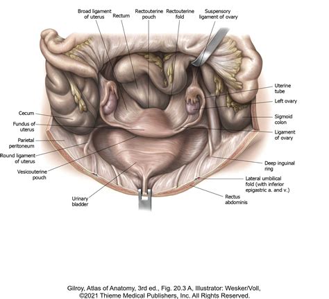 Medial Umbilical Ligament Cadaver