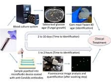 Fungal Blood Infections: The Paired Test Approach Explained | Diseases ...