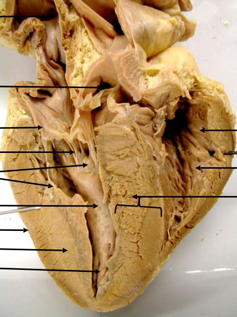 Image result for Heart Dissection Tutorial