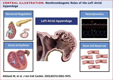 Nonthrombogenic Roles of the Left Atrial Appendage: JACC Review Topic of the Week | Journal of ...