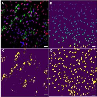 Create Masks Python 的图像结果