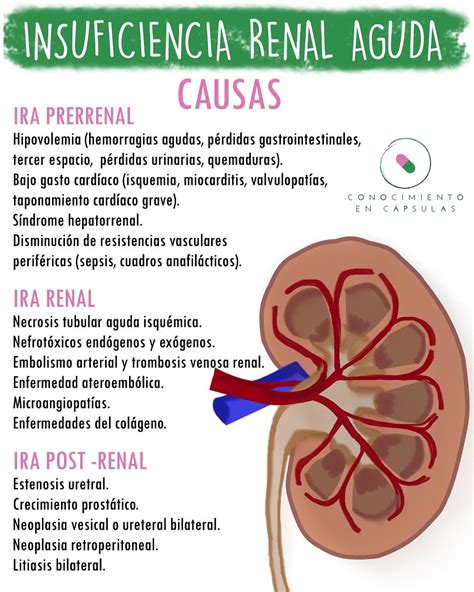 Insuficiencia Renal Aguda Pré Renal - RETOEDU