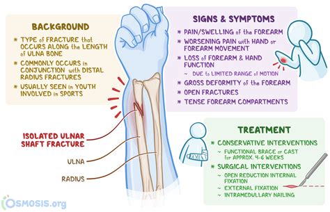 Distal Ulna Fracture: What Is It, Management, and More | Osmosis