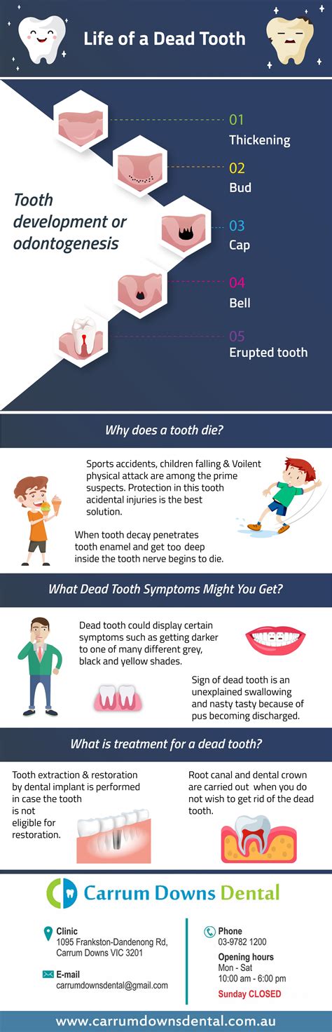 Dead Tooth - Causes, Symptoms, Treatment | Infographics