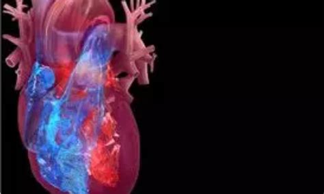 Hypertension patients with shortened fingers and genetic mutation ...