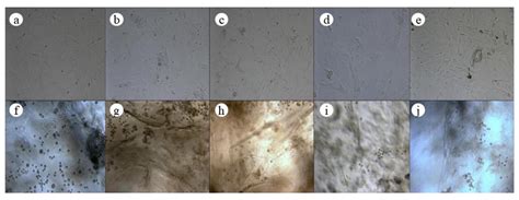 Jawbones Scaffold Constructed by TGF-β1 and BMP-2 Loaded Chitosan ...