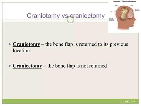 Decompressive craniectomy | PPTX