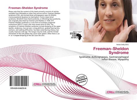 Freeman–Sheldon Syndrome, 978-620-0-84255-8, 6200842558 ,9786200842558