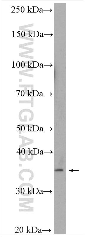 SLC10A2/ASBT antibody (25245-1-AP) | Proteintech