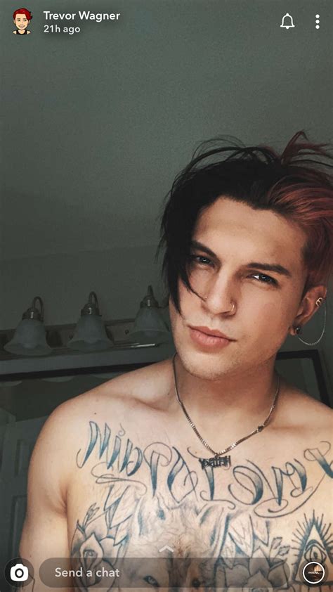 Trevor Wagner Face Surgery