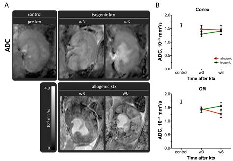 Diffusion-Weighted Imaging and Mapping of T1 and T2 Relaxation Time for ...