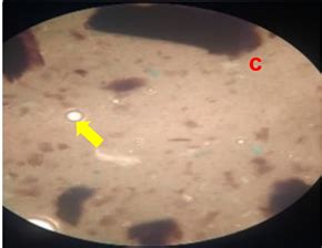 Physical, Chemical and Antibacterial Characterization of Hand Sanitizer ...