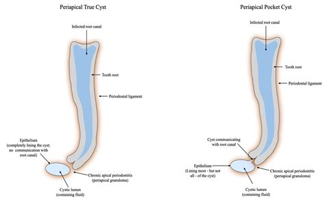 The Limitations of Periapical X-ray Assessment in Endodontic Diagnosis—A Systematic Review