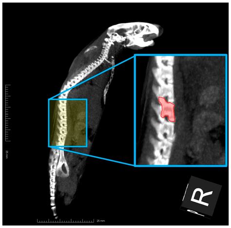 Prevention of Osteoporosis in SAMP6 Mice by Rikkunshi-To: Japanese ...
