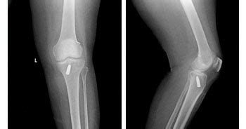 Orthopedics Treatments,Trauma Care Treatments | Neuro & Plastic Surgery