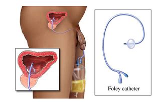 Image result for Patient Bad Example