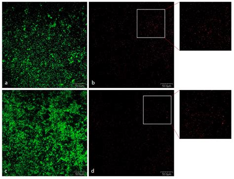 Streptococcus salivarius as an Important Factor in Dental Biofilm ...