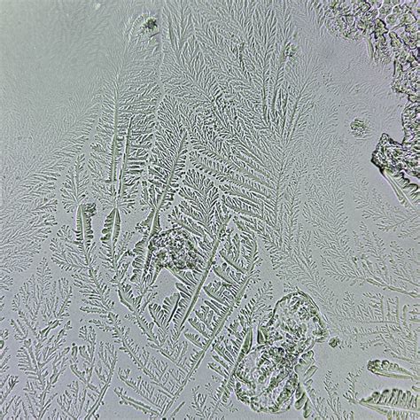 Fern Test Overview: Appearance and Clinical Significance
