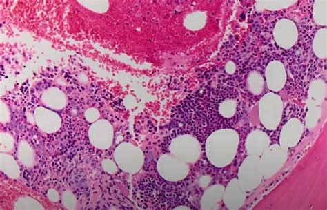 Image result for MDS Code