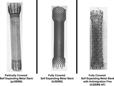 Performance and Predictors of Migration of Partially and Fully Covered Esophageal Self-Expanding ...