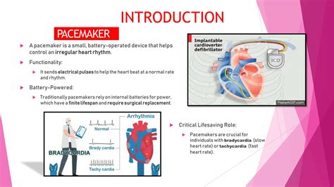 Wireless Charger for implantable pacemakers.pptx