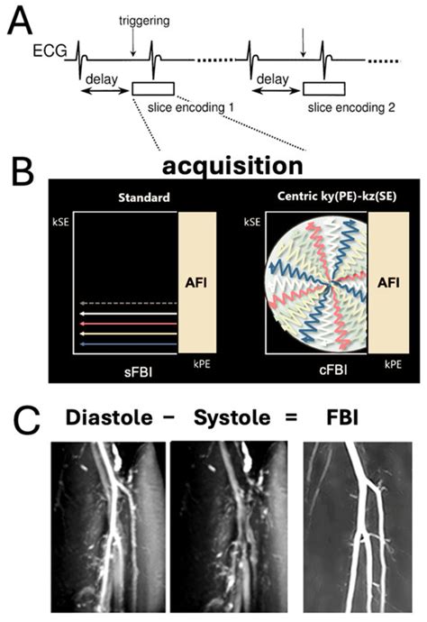Three-Station Non-Contrast MR Angiography of the Lower Extremities ...