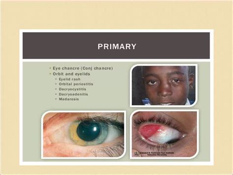 Image result for Syphilis Testing Algorithm
