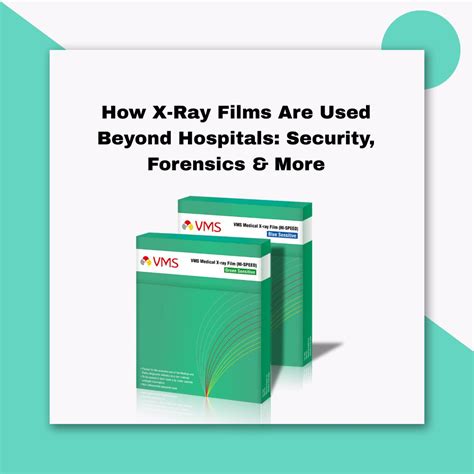 How X-Ray Films Are Used Beyond Hospitals | vmscart.com – VMS Cart