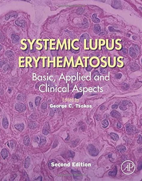 Buy Systemic Lupus Erythematosus: Basic, Applied and Clinical Aspects ...