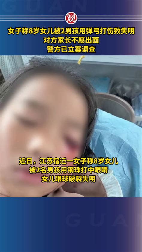 女子称8岁女儿被2男孩用弹弓打伤致失明，对方家长不愿出面，警方已立案调查|弹弓_新浪新闻
